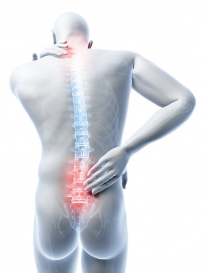 Mal di schiena (Low Back Pain): l'origine è spesso idiopatica - Centro  Fisioterapia Roma